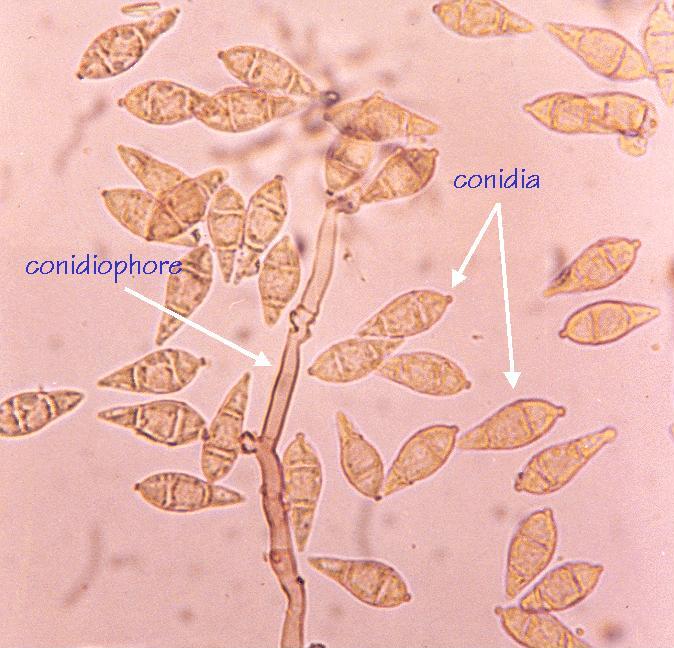 piricularia oryzae
